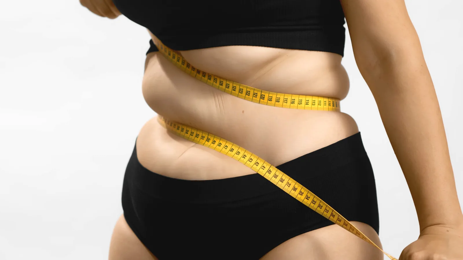 Tratamento da obesidade ainda alcança parcela restrita da população, diz médica