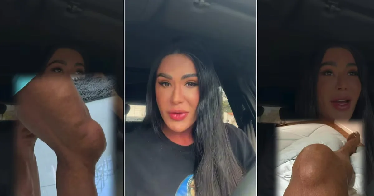 Gracyanne detalha recuperação de lesão no joelho durante retorno ao Dança dos Famosos