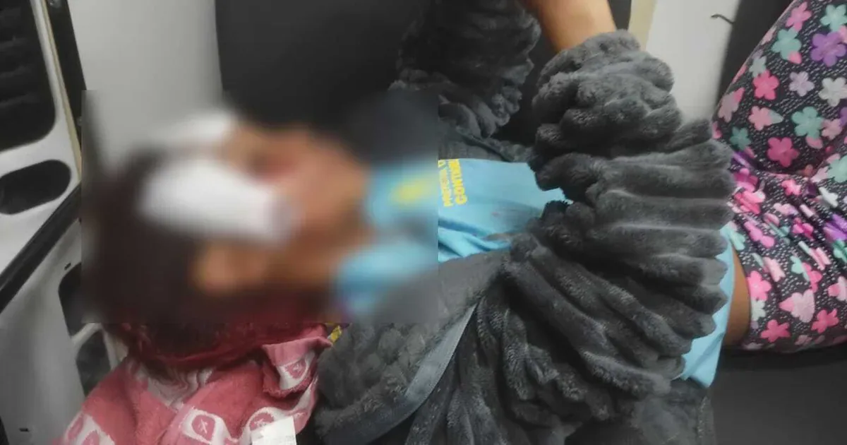 Queda de patinete deixa menina ferida após fuga de cachorro em Contagem