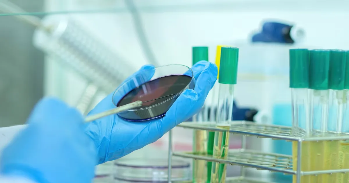 Teste em UTIs reduz espera por diagnóstico de bactérias resistentes