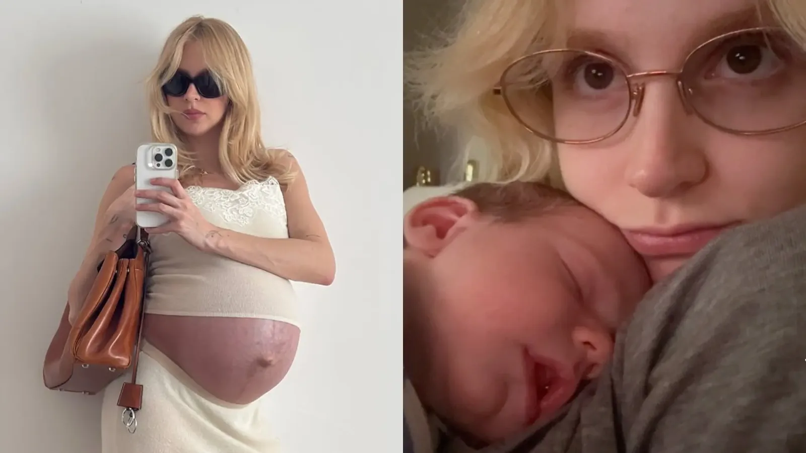 Isabella Scherer diz que pretende fazer abdominoplastia após amamentação